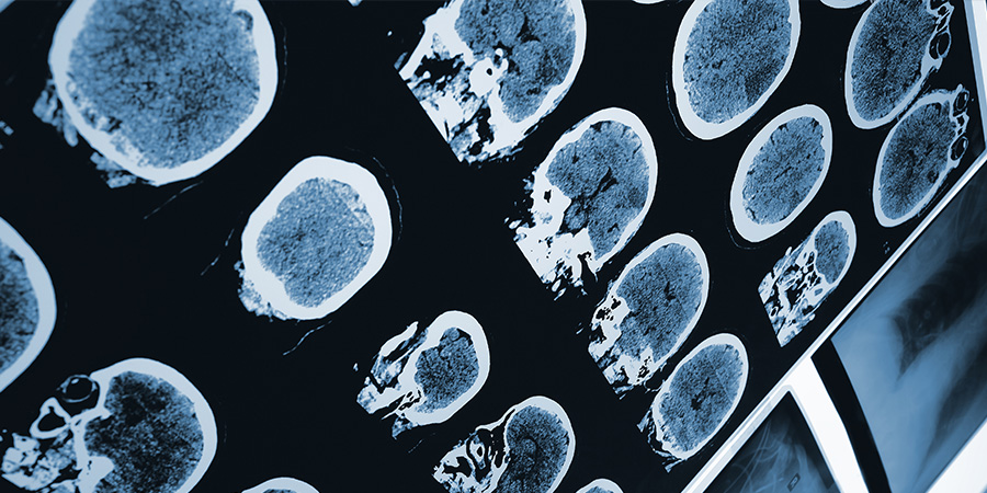 medical images of brain scan. cross sections shown