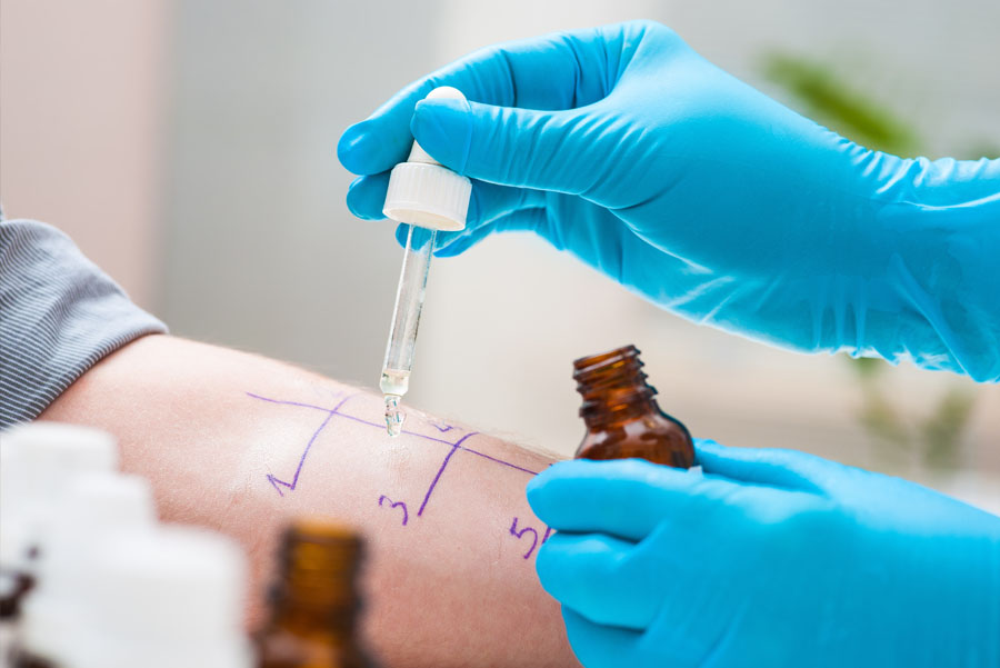Doctor performing skin prick allergy test on patient’s arm