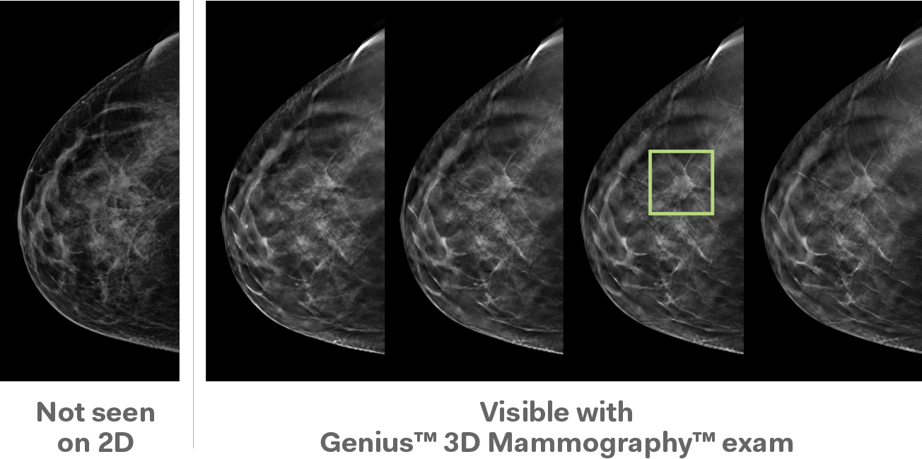 Web 3D-vs-2D-improved-detection