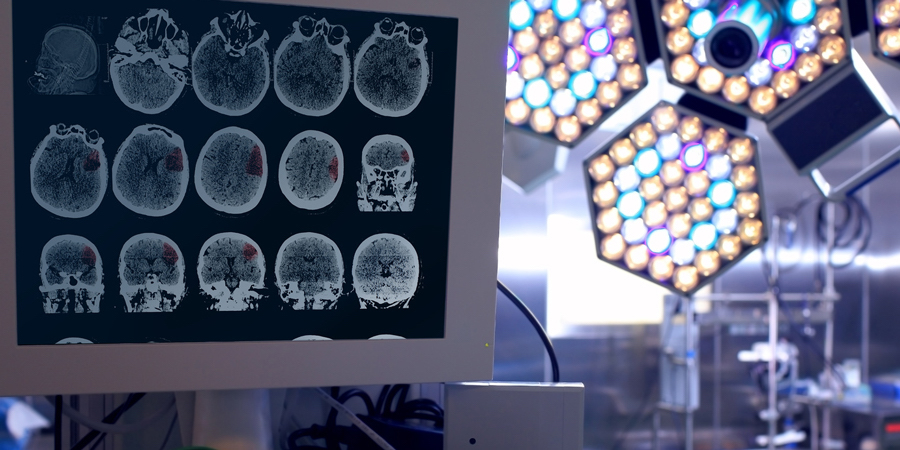 Medical monitor displays multiple brain scan images alongside bright surgical lights inside an operating room, illustrating neurological imaging and care in a clinical setting