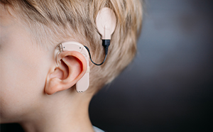 Pedi-CochlearImplant