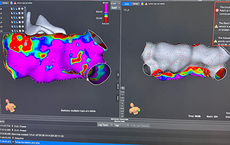 Computer view of heart