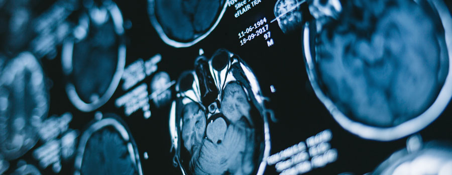 Detailed brain MRI images are displayed to support diagnosis and treatment planning for neuro oncology care.