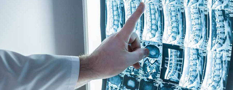 A provider points to spinal imaging to explain a diagnosis during a spine and peripheral nerve evaluation at UTMB Health.