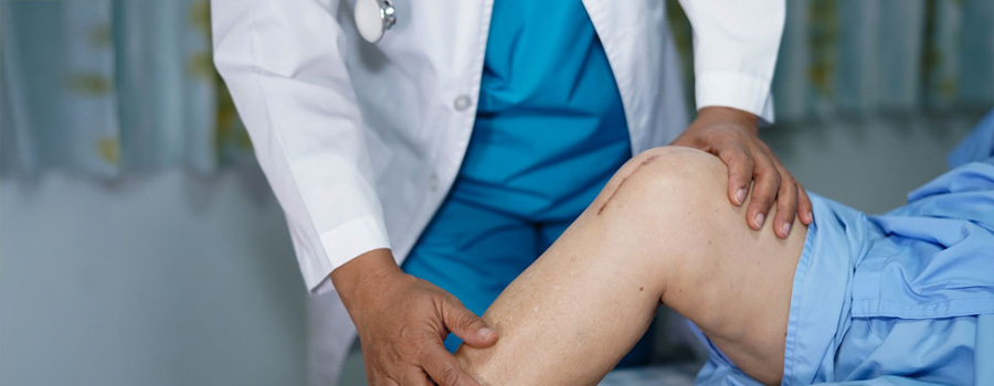 Patient at UTMB Health shows her surgical knee scar after total knee joint replacement, suture wound surgery arthroplasty