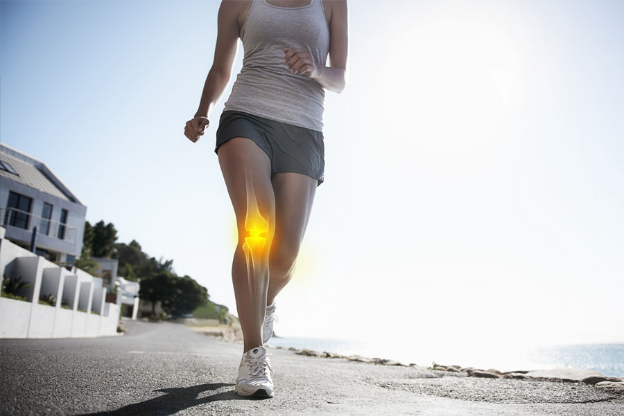 Closeup shot of woman from the neck down jogging down a sidewalk in neighborhood along the coast, with X-ray image of knee bone highlighted.