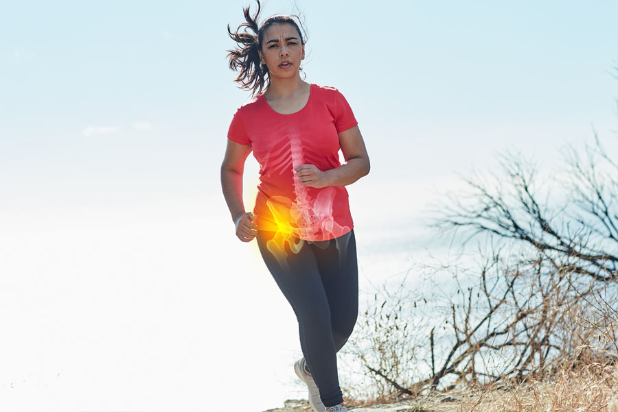Woman running outdoors, X-ray of her hip highlighted to show an injury.