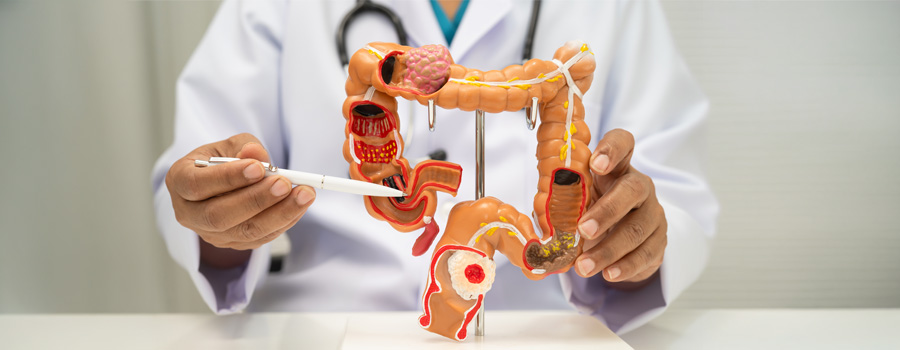 Closeup human anatomy model of colon, with doctor in background pointing to it with a pen