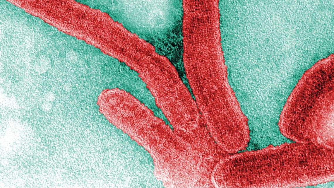 Colorized electron microscope image showing elongated, thread‑like Marburg virus particles against a textured background, illustrating the deadly virus targeted by new mRNA vaccine research