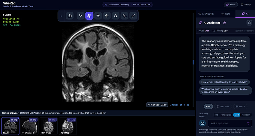 VibeRad is a DICOM viewer and teaching tool that allows users of various skill levels to learn from medical images. A screenshot shows a series of images of a brain. One image is in the main viewing area. On the right side of the screen, an AI Assistant chat offers several prompts a user might choose to learn about the image.